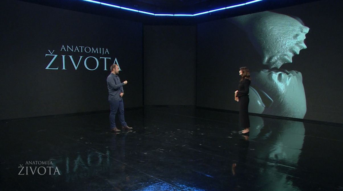 Osteoartritis je progresivno oboljenje, gdje dolazi do progresivnog oštećenja hrskavice.