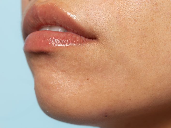 Preporučuje prestanak pušenja, smanjenje unosa alkohola, prehranu s niskim udjelom soli te povećanje tjelesne aktivnosti i upravljanje stresom