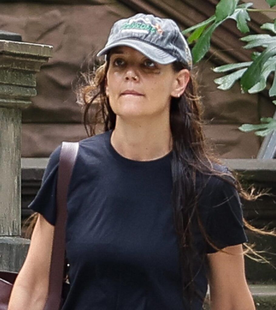 Glumica natečena i sa modricom ispod oka: Svi se pitaju šta se dogodilo Katie Holmes