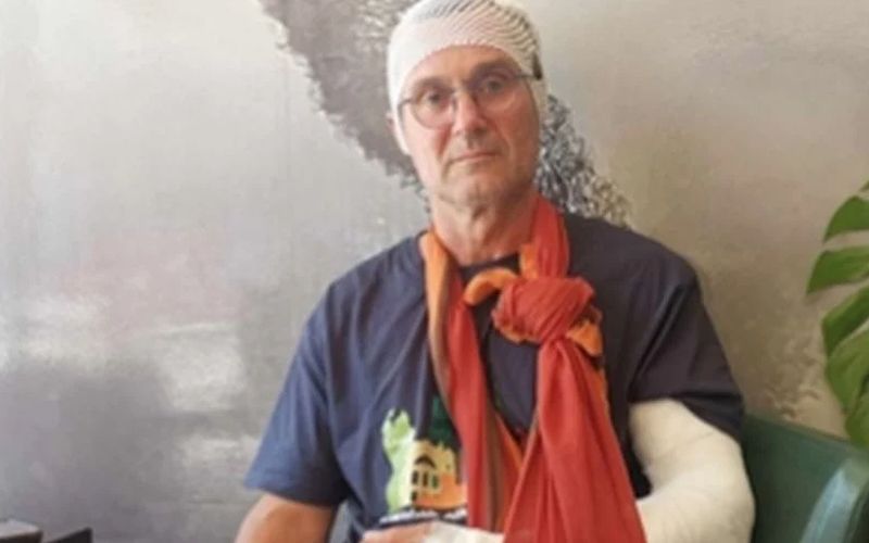 Boris Kašljević, žrtva napada, za Dalmatinski portal ispričao je da već duže vrijeme ima problema s osumnjičenicima