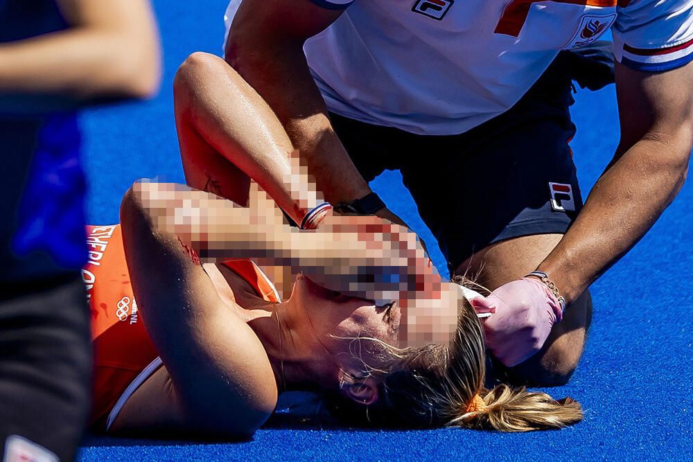 Mnogo je ovdje krvi. Ljekari čine sve da zaustave krvarenje - rekao je komentator Eurosporta