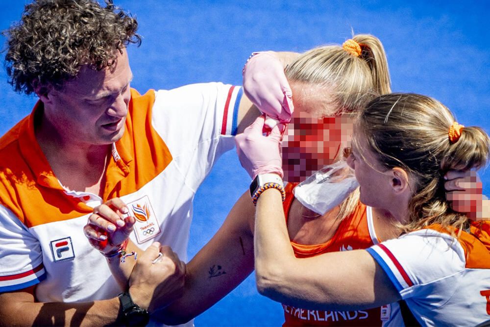 Mnogo je ovdje krvi. Ljekari čine sve da zaustave krvarenje - rekao je komentator Eurosporta