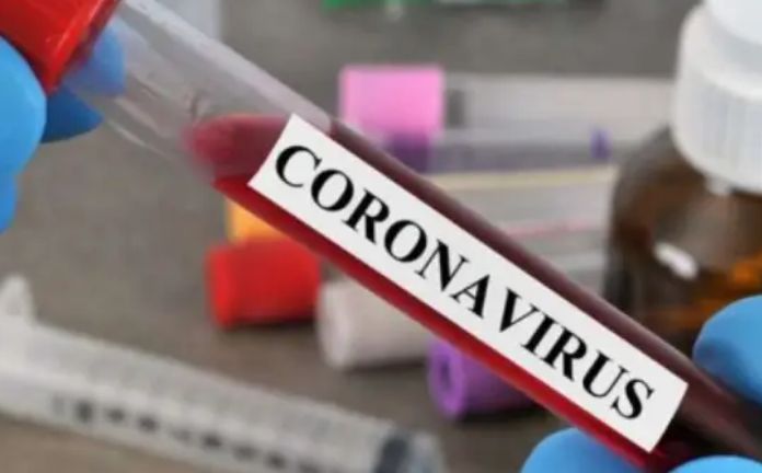 Pacijenti najčešće razvijaju upalu pluća sa bakterijskim komplikacijama, nakon nekoliko dana bolesti 