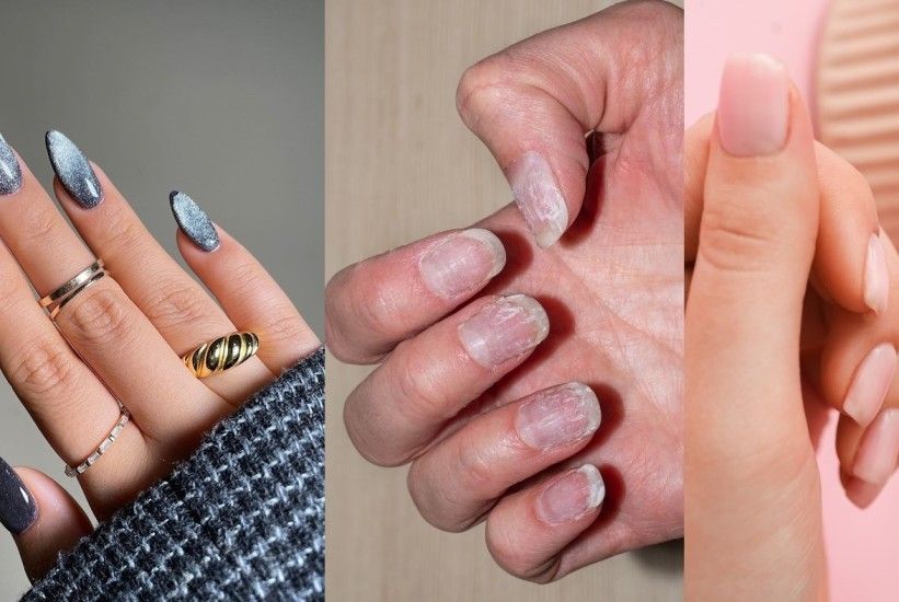 Iako gel lak obično traje duže od običnog lakiranja i pruža prirodniji izgled od akrila, ima i svoju manu