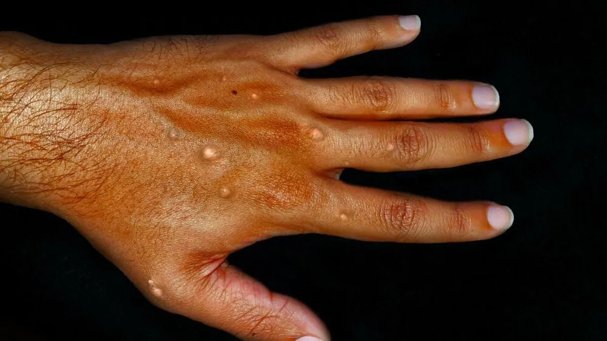 Vakcinacija za rizične grupe bit će dostupna najmanje do kraja ove godine