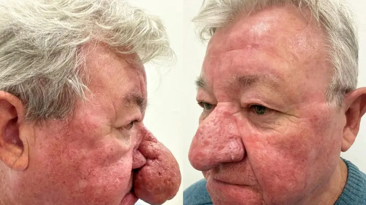 Gerard, koji je 30 godina radio u IBM-u, trpio je sve dok njegova supruga nije odlučila preuzeti stvari u svoje ruke i odvela ga u estetsku kliniku