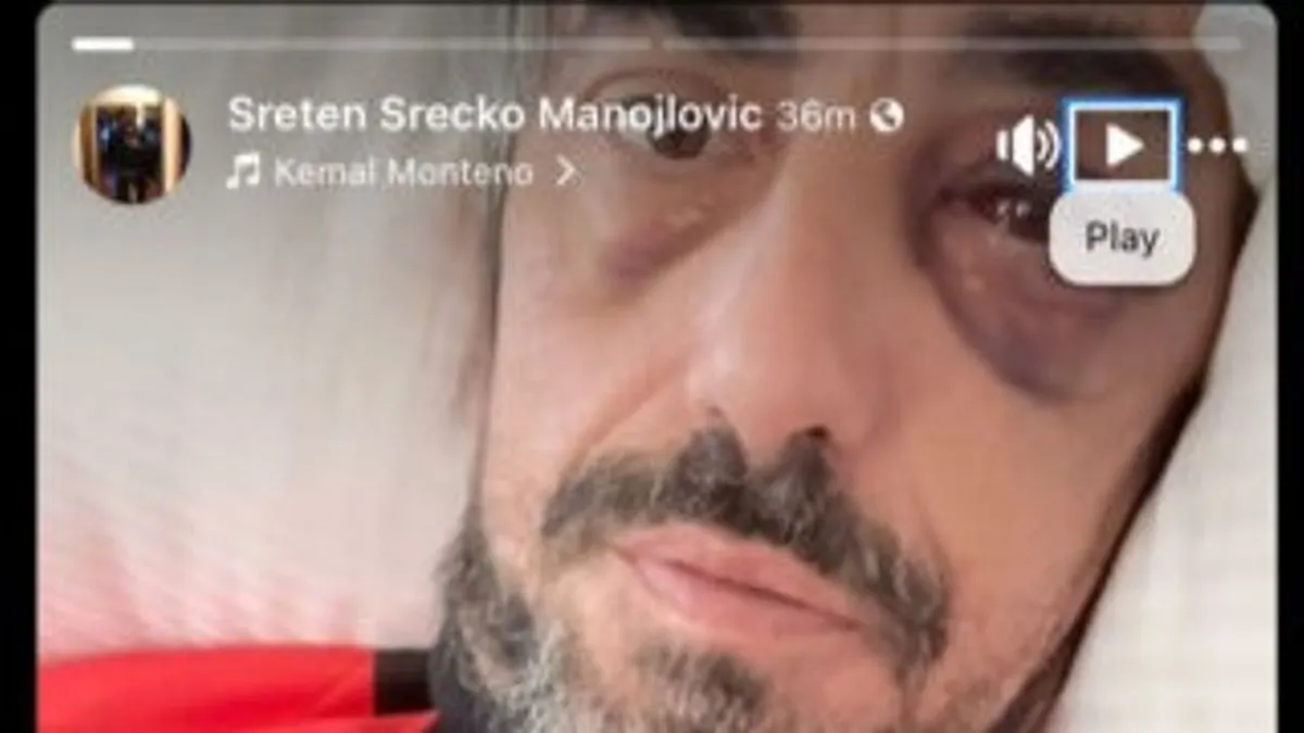 Sreten Srećko Manojlović se javio iz bolnice i poslao poruku napadačima: Izlazim uskoro...