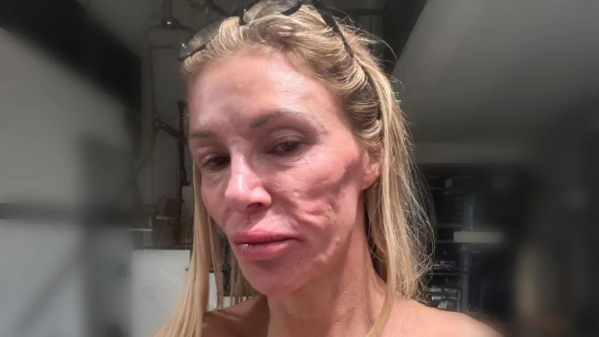 Glanville je prošla kroz niz zahvata, uključujući nekoliko biopsija kože kako bi riješila ovaj problem. 