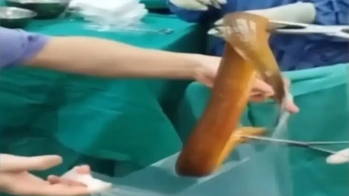 Njegova priča u početku je zvučala nevjerovatno, ali su snimci urađeni rendgenom i ultrazvukom vrlo brzo potvrdili sumnje doktora.