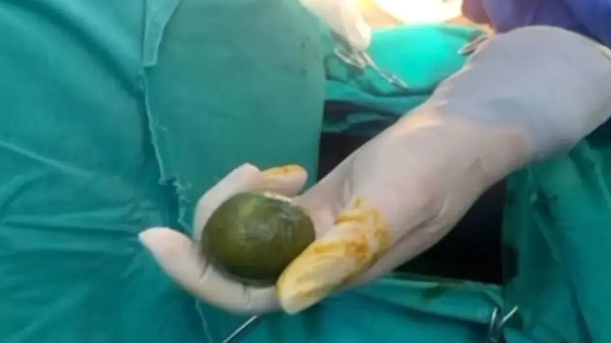 Njegova priča u početku je zvučala nevjerovatno, ali su snimci urađeni rendgenom i ultrazvukom vrlo brzo potvrdili sumnje doktora.