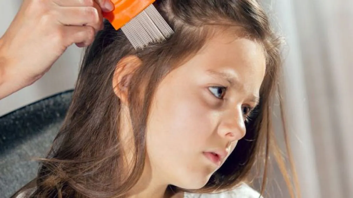 Roditelji u panici zbog pojave vaški u školama!