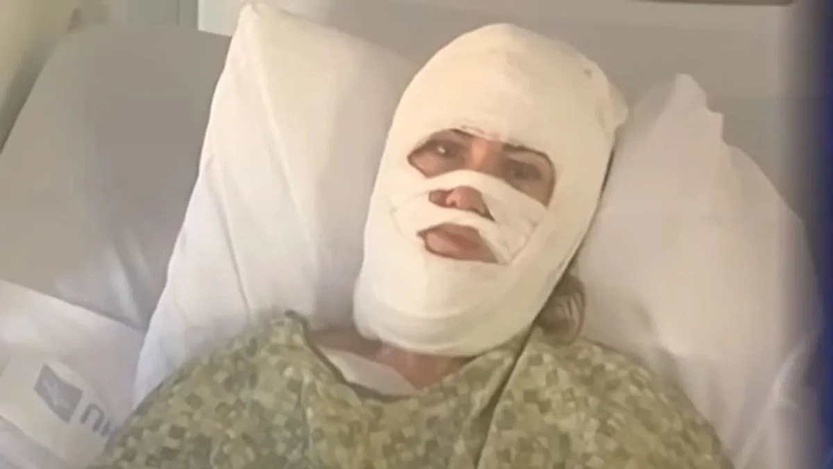 Načelnik policije potvrdio je da su policijske patrole pojačane u svim gradskim parkovima