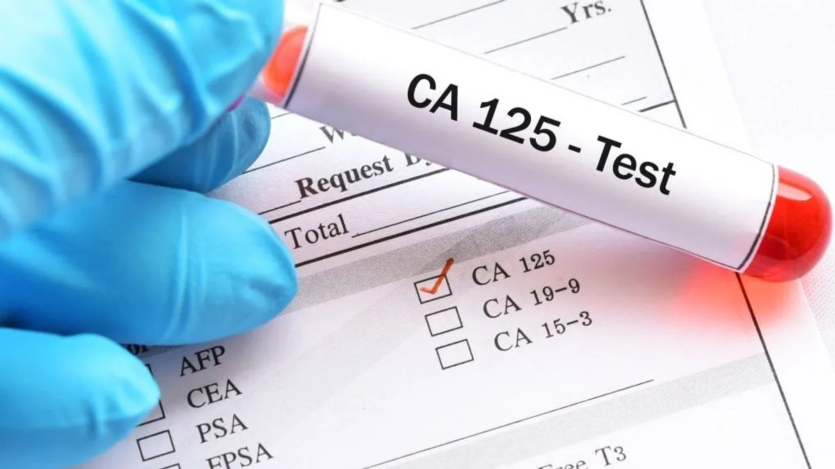 Najvažniji rizični razlog za razvoj raka prostate je dob. Gotovo isključivo se javlja kod muškaraca starijih od 40 godina, s povećanim rizikom od 50. 