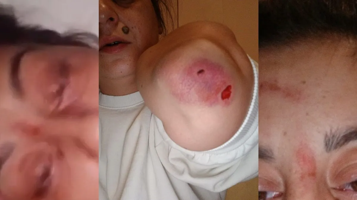 Nakon kriminalističke obrade, on je predat Tužilaštvu Kantona Sarajevo na čiji prijedlog je od Općinskog suda Sarajevo određen pritvor.