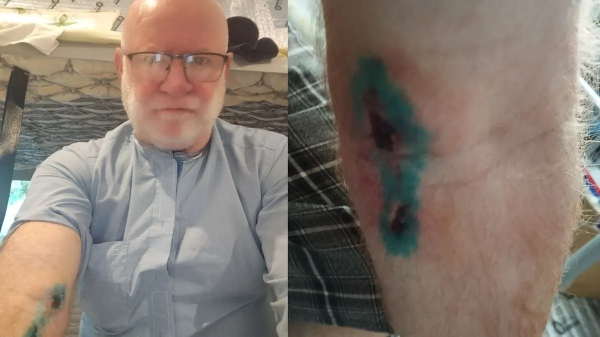 Ratovanje na stranim ratištima, kao i u BiH, kažnjivo je zakonom i u Srbiji sa rasponom kazni od nekoliko mjeseci do nekoliko godina zatvora.