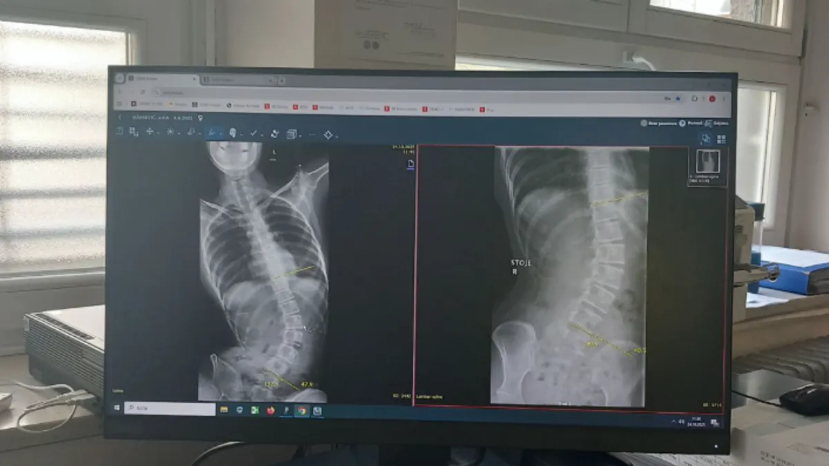 Teška sudbina Aide Jašarević! Pomozimo joj da pobijedi bolest: pozivom na 17117 darujete 2 KM