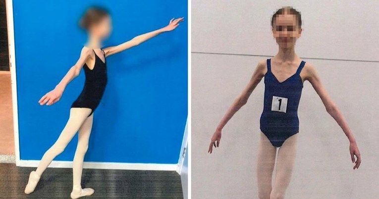 Svjedoci iz bolnice rekli su da su se roditelji prema njoj ponašali kao prema malom djetetu