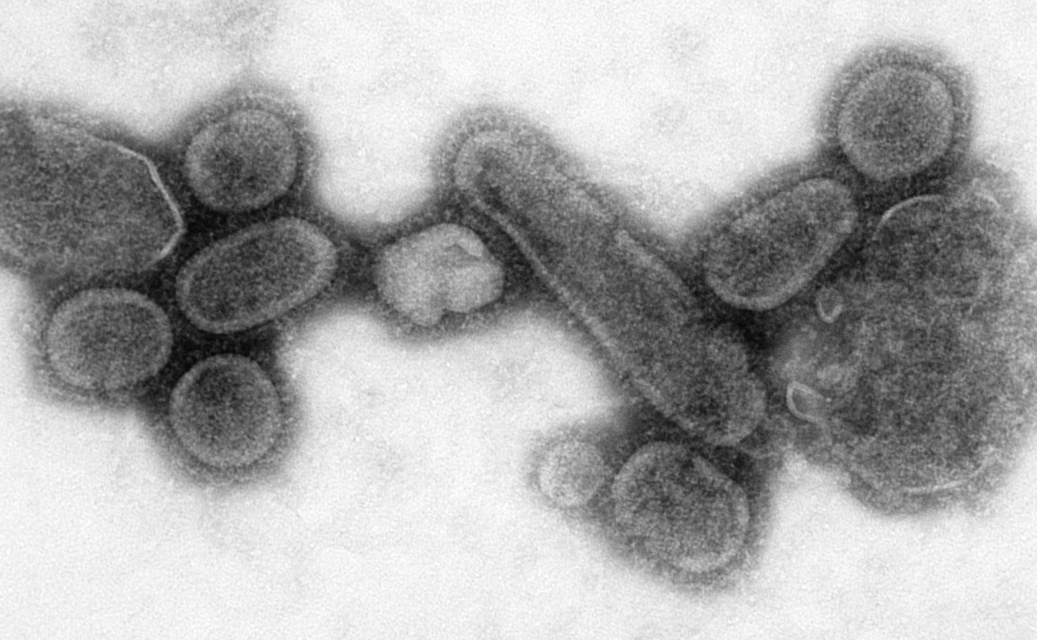 Na rubu smo pandemije! Virus se širi farmama širom SAD-a