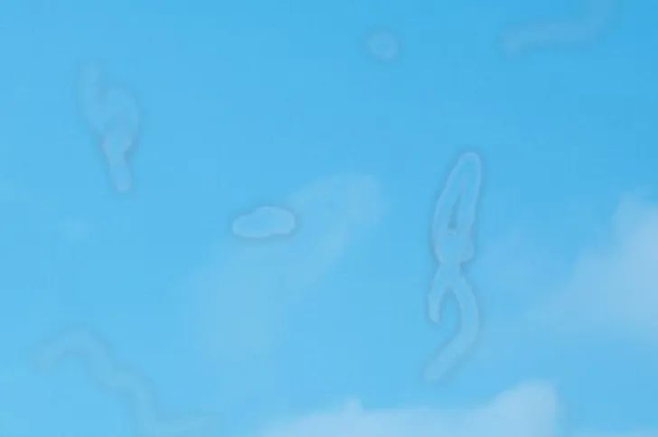 Mogu vam izgledati kao crne ili sive mrlje, niti ili paučina