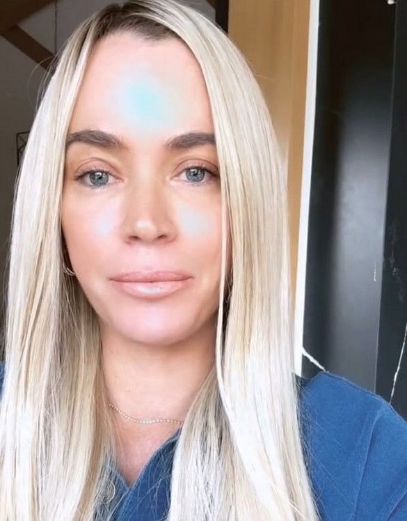 Reality zvijezda išla na operaciju tumora mozga: Pronašli su mi još pet tumora