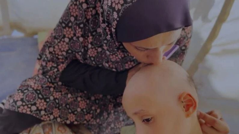 Čak i uz primirje, kosa joj nije ponovno narasla i pita se hoće li ikada.