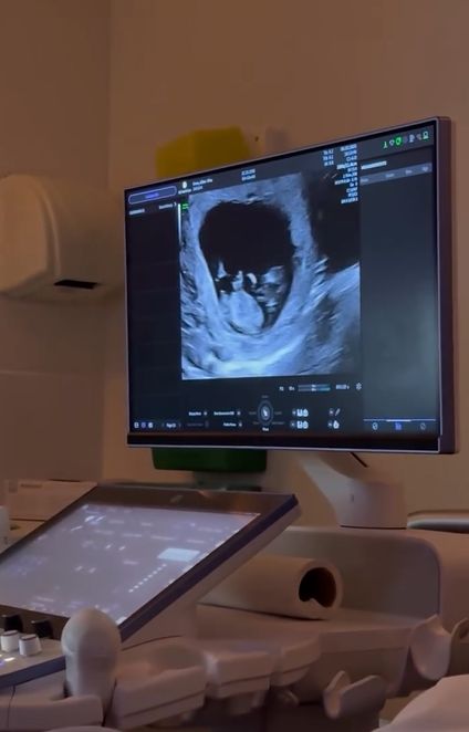 Zvijezda Liverpula sve iznenadio: Ostavio djevojku zbog njene najbolje drugarice, sada čeka dijete