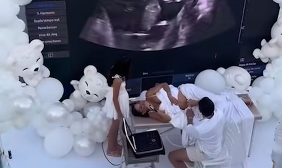 Vjerovali ili ne, buduća mama je uživo, pred publikom, radila ultrazvuk