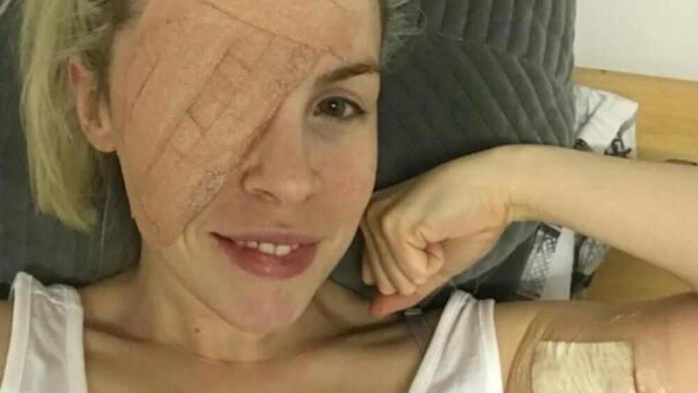 Nakon što je jedne jutro protrljala oko, koža sa lezije se odvojila i počela da krvari