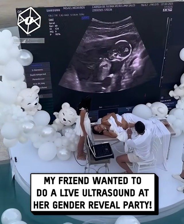 Vjerovali ili ne, buduća mama je uživo, pred publikom, radila ultrazvuk