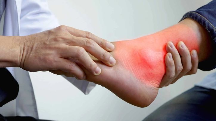 Ovako izgleda napad gihta: Doktor objašnjava kako se liječi to bolno stanje