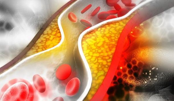 Holesterol ima ključnu ulogu u našem organizmu, ali visok nivo holesterola može biti opasan, posebno za srce i krvne žile.