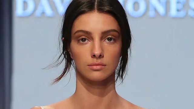 Ona je prošlog mjeseca na društvenim mrežama objavila da ide na operaciju mozga zbog arteriovenske malformacije