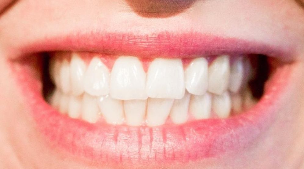 Za razliku od slatkiša koji odmah potiču stvaranje kiselina, škrobne grickalice poput čipsa ostaju zalijepljene za zube i između njih.