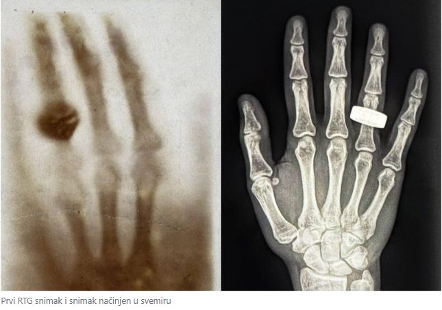 Medicinski rendgenski snimak ljudske ruke uspješno je napravljen u svemiru prvi put u historiji.