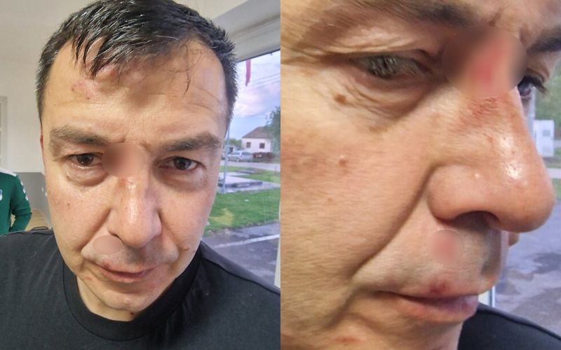 Novo nasilje nakon fudbalske utakmice se desilo u Maglajanima kada su otac i sin pretukli sudiju u svlačionici.