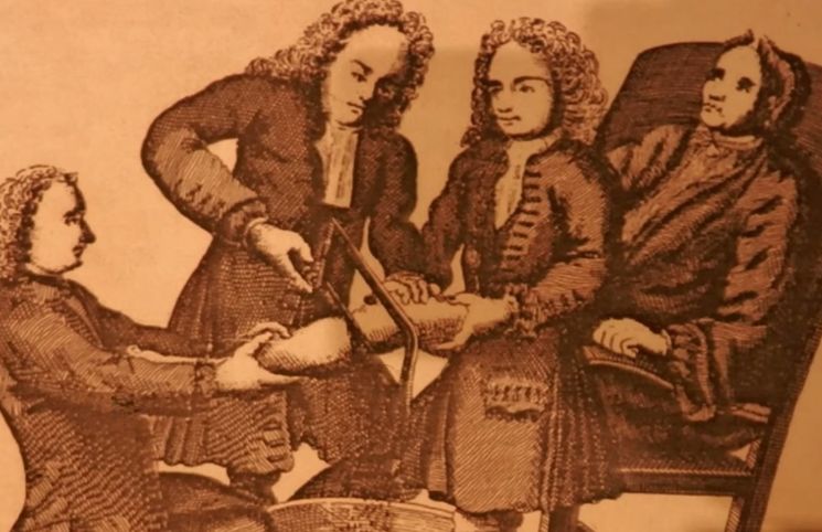 Robert Liston, škotski hirurg iz 19. vijeka, postao je legenda ne samo zbog svojih hirurških vještina, već i zbog nevjerovatne brzine kojom je amputirao udove.