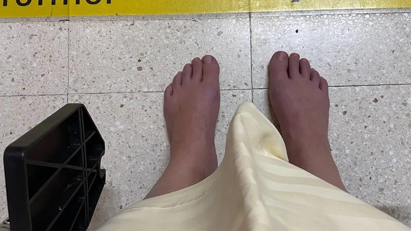 Nije bilo crvenila, nije bilo simptoma – sve do devet mjeseci kasnije, kada su počeli prvi znaci paralize