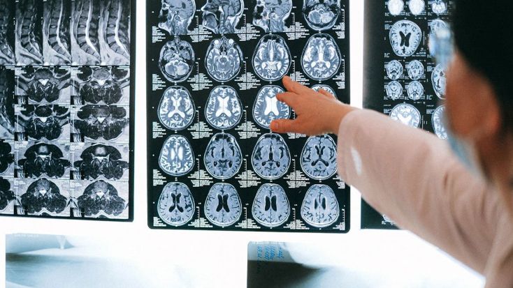 Neurolozi otkrivaju šest stvari koje nikad ne rade kako bi sačuvali zdravlje mozga
