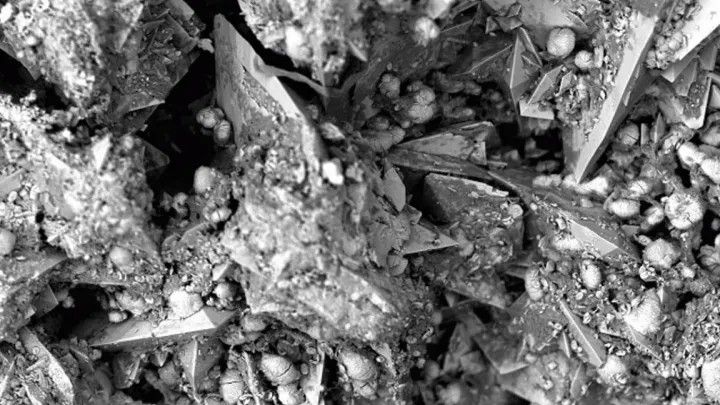 Ovo je 'najveća bol koju čovjek može osjetiti': Iskustva pacijenata su jeziva