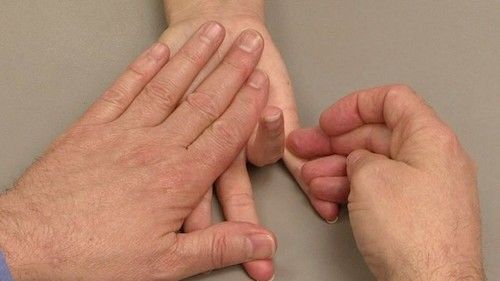 Vezivno tkivo, kao što su zglobovi i tetive, je 'lijepak' tijela koji podržava i daje strukturu kostima, mišićima i organima