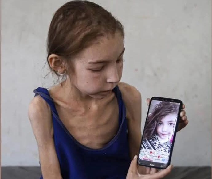 Gaza – groblje djece! Pogledajte kako su monstrumi od prelijepe djevojčice napravili bolesnu staricu