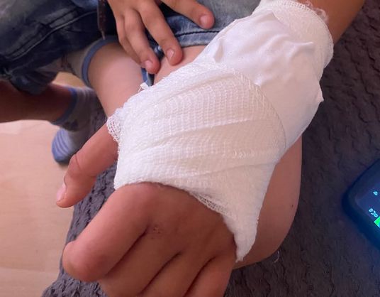 Dijete je bilo svjesno, komunikativno, ali sa vidljivim povredama, uključujući i ekskorizacije (ogrebotine) na licu i podlivima