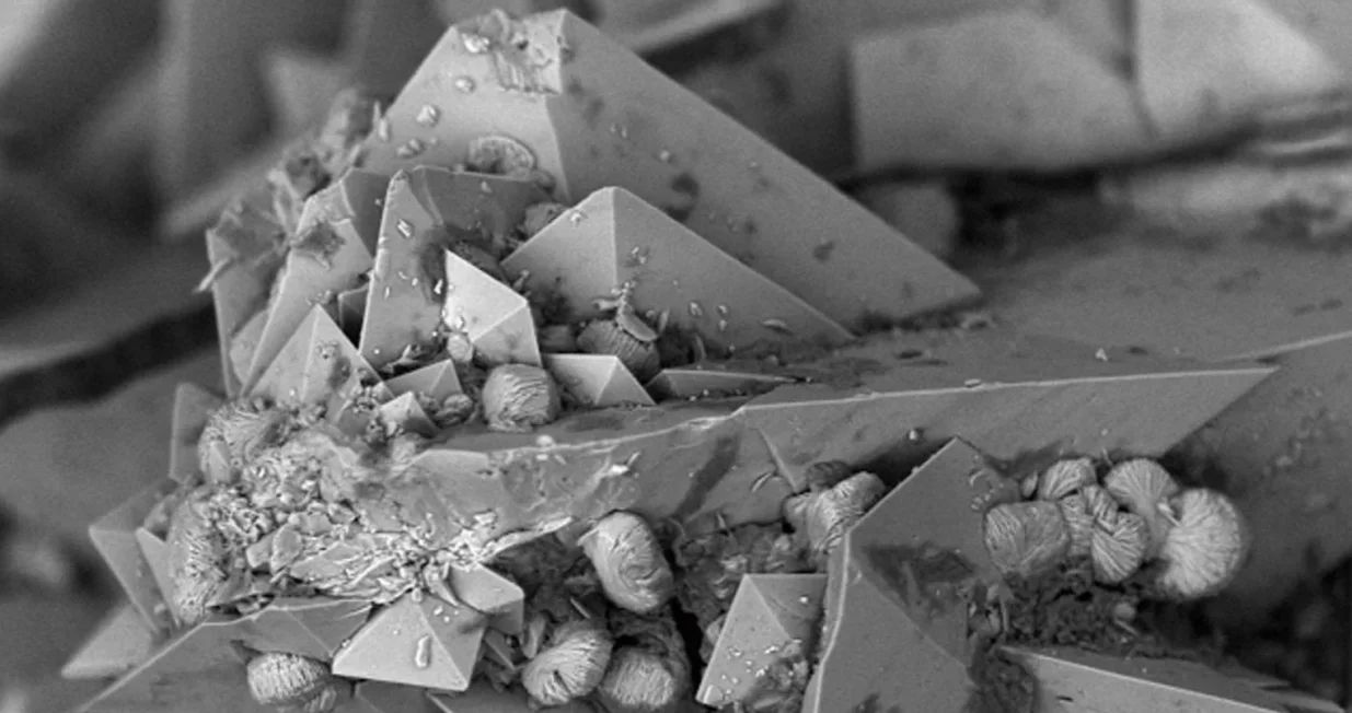 Međutim,  istraživanja već godinama upozoravaju da postoji još nešto teže podnošljivo, a to su bubrežni kamenci