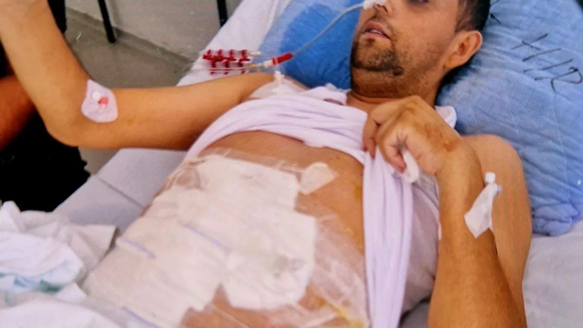 Elvis Seferović ima samo 35 godina, ali je njegovo lice starije od njegovih godina. 