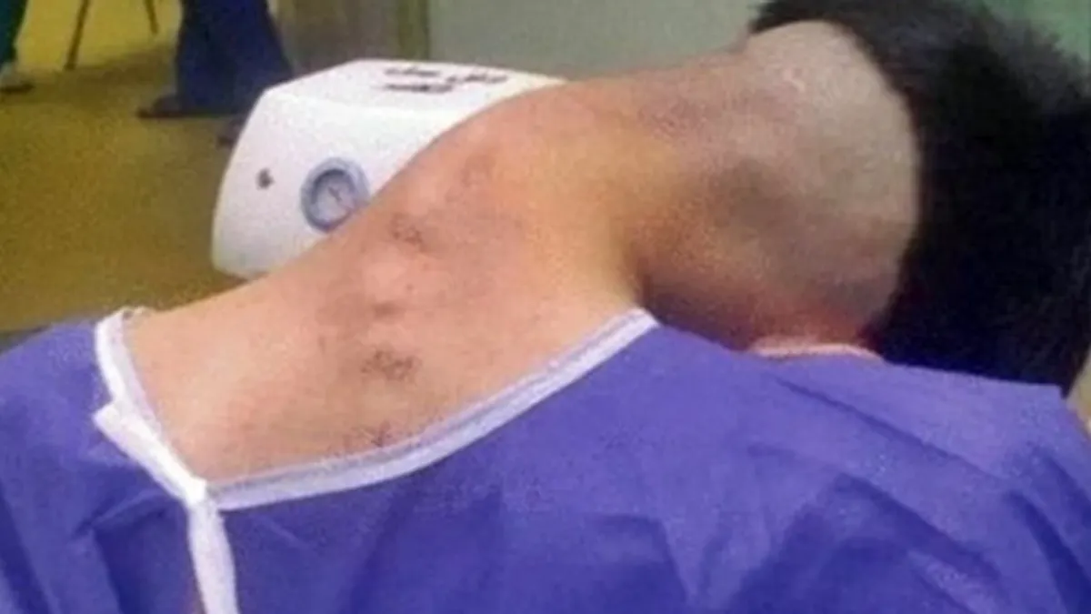 Mladiću (23) se tijelo izobličilo na zastrašujući način, onda su ljekari saznali i zašto