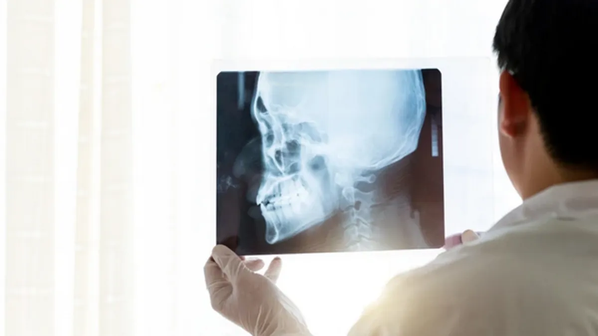 Sindrom spuštene glave poznat je kao "cervikalna kifoskolioza"