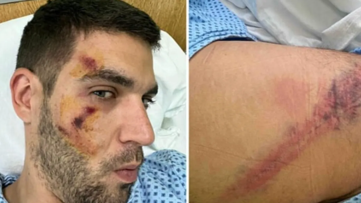 'Režimska policija' pretukla svog kolegu: Strašne fotografije objavljene iz bolnice