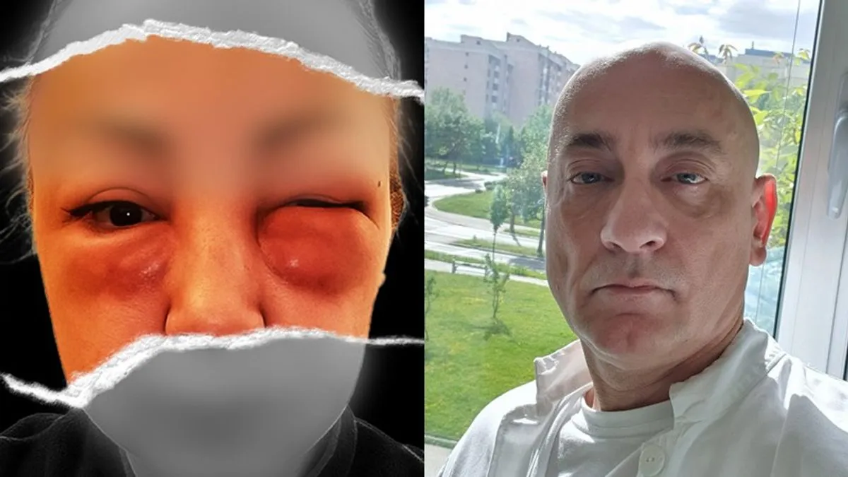 Nekoliko dana je slala doktoru fotografije lica koje je svakim danom izgledalo sve gore