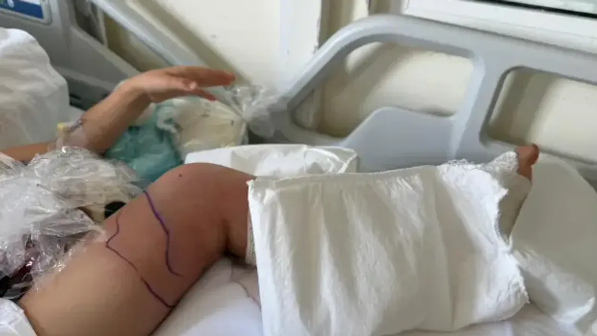 Djevojčica (5) izašla iz bolnice nakon ugriza poskoka: Podigla sam kredit da platim liječenje