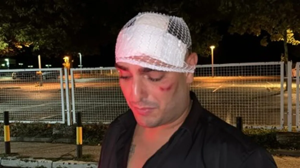 Folker Darko Lazić sinoć je doživio tešku saobraćajnu nesreću na autoputu, a sa njim je u kolima bila njegova supruga Katarina Lazić.